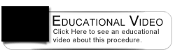 Dental Education Video - Gingivitis